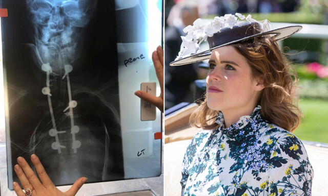 Prinsessen åpner opp om sykdommen